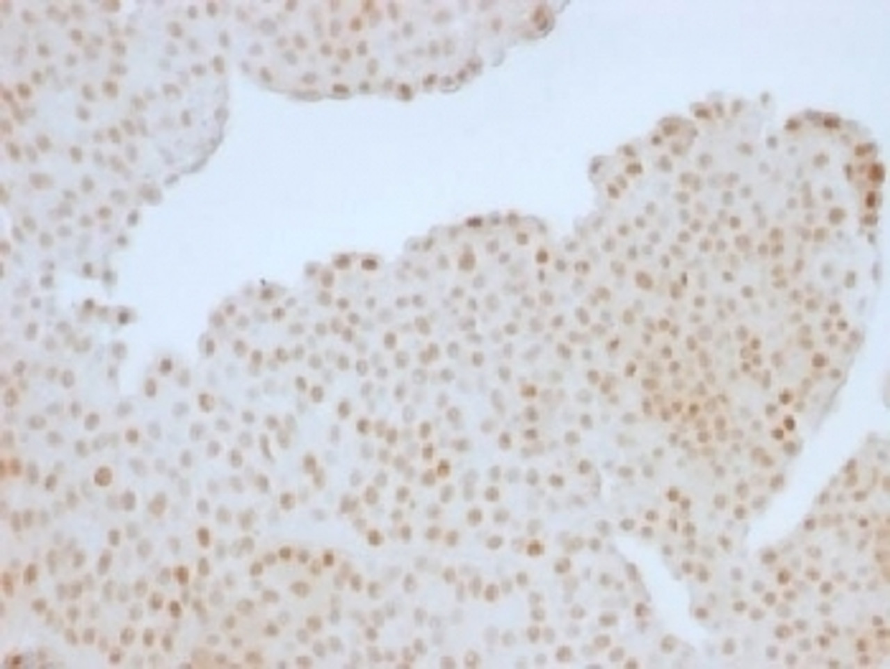 IHC testing of human colon with Rb antibody (clone RB1/1754) . Required HIER: boil tissue sections in 10mM citrate buffer, pH 6, for 10-20 min followed by cooling at RT for 20 min.