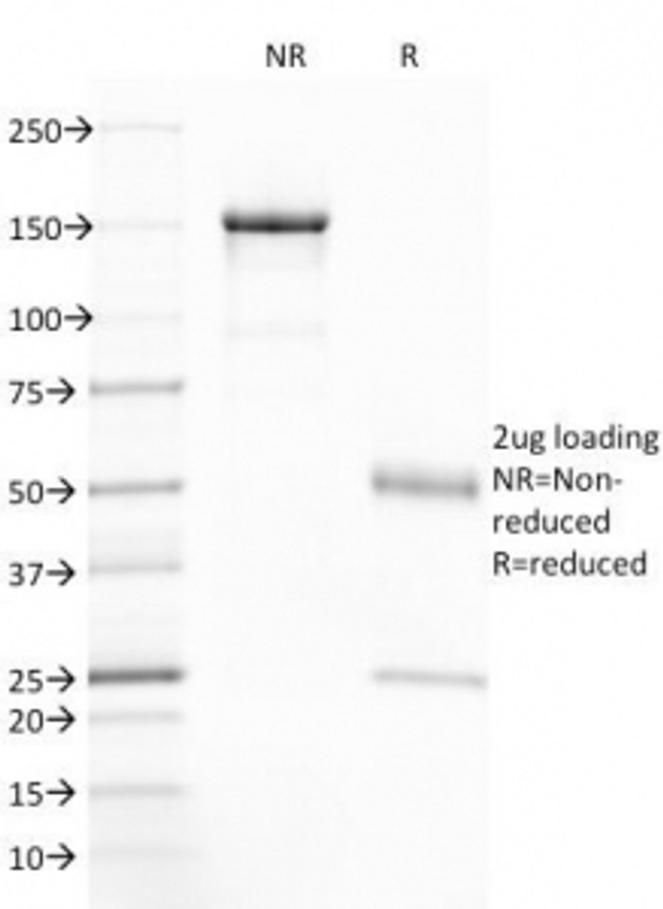SDS-PAGE Analysis of Purified, BSA-Free CFTR Antibody (clone CFTR/1785) . Confirmation of Integrity and Purity of the Antibody.