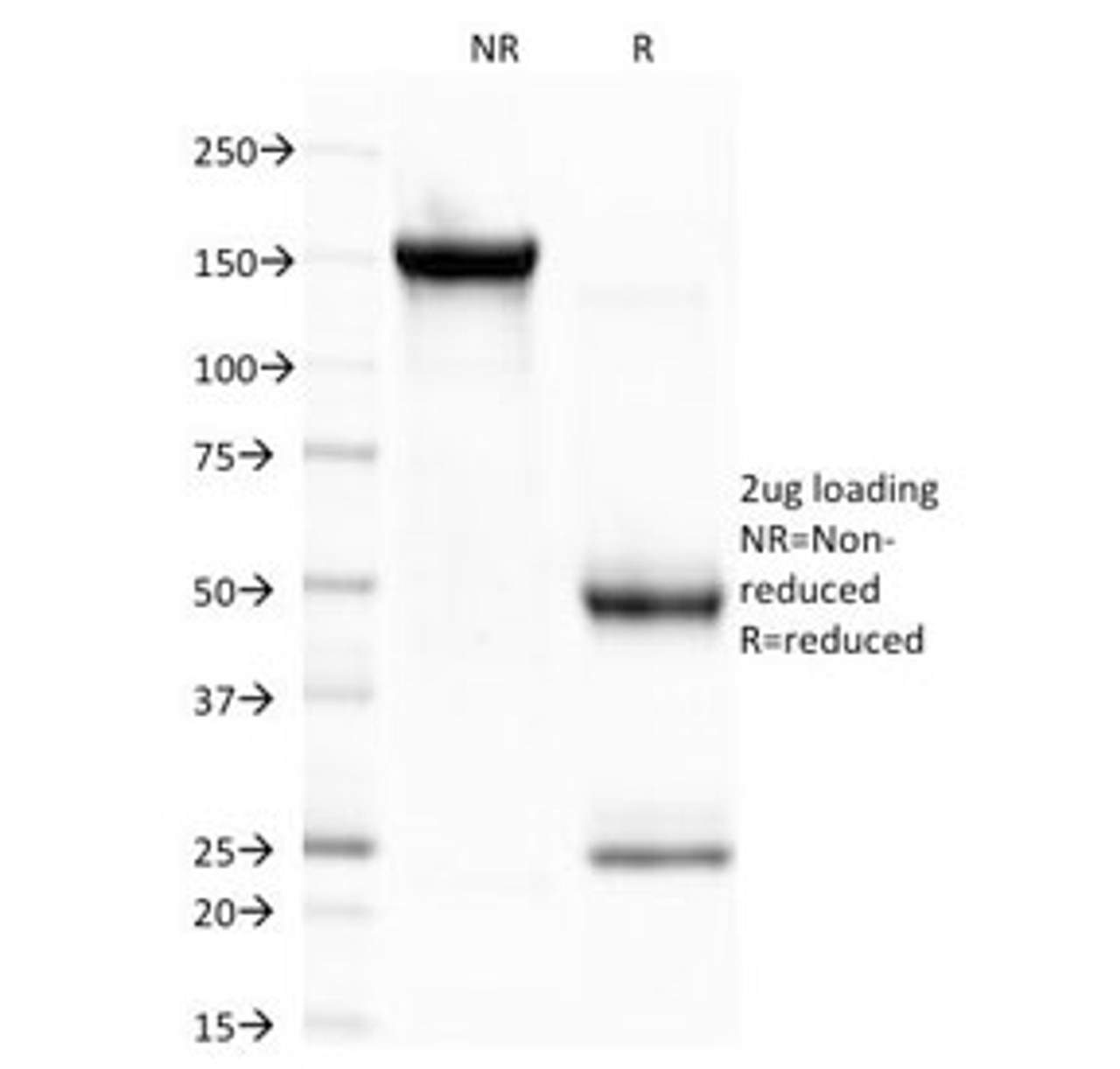 SDS-PAGE Analysis of Purified, BSA-Free CELA3B Antibody (clone CELA3B/1757) . Confirmation of Integrity and Purity of the Antibody.