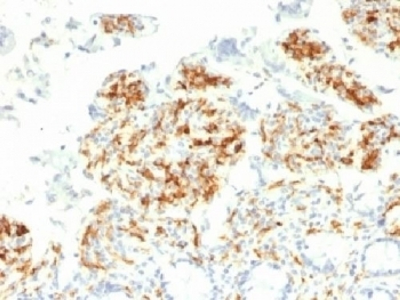 IHC testing of FFPE human small intestine with DC-SIGN antibody (clone C209/1781) . Required HIER: boil tissue sections in 10mM Tris with 1mM EDTA, pH 9, for 10-20.