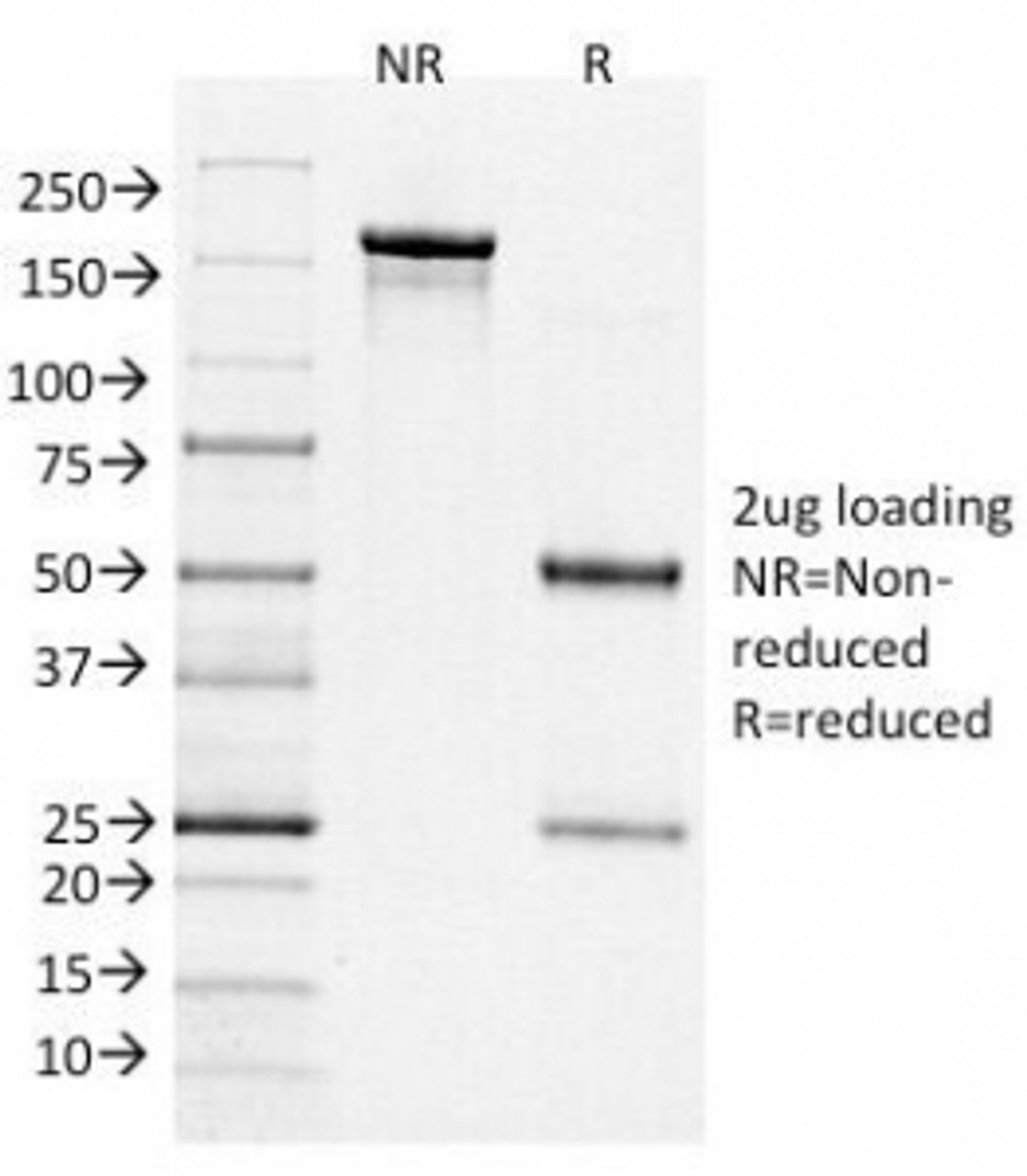 SDS-PAGE Analysis of Purified, BSA-Free Bcl6 Antibody (clone BCL6/1526) . Confirmation of Integrity and Purity of the Antibody.