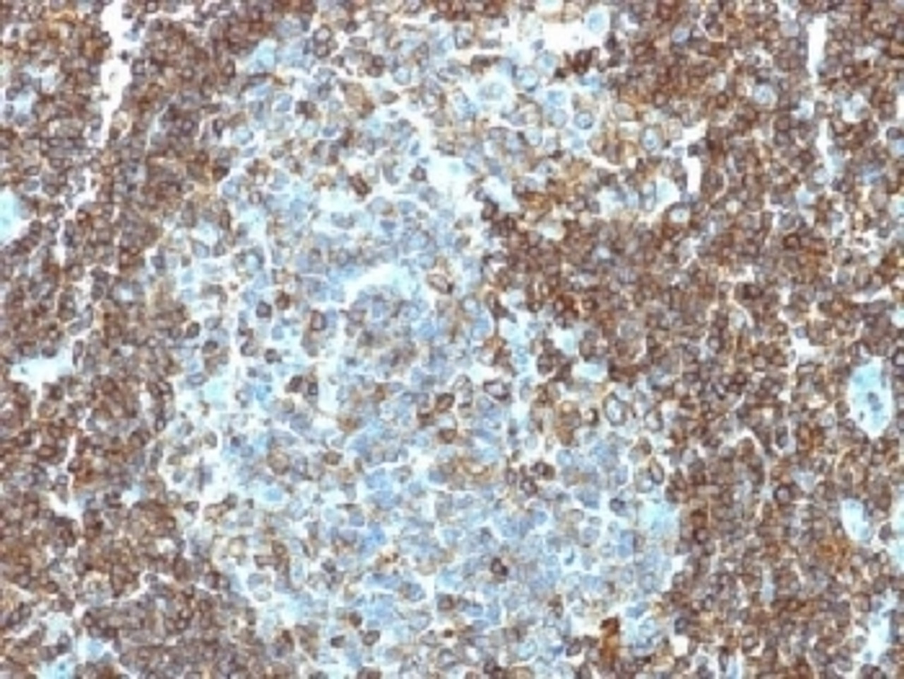 IHC testing of human tonsil tissue with CD3e antibody (clone PC3/188A) . Required HIER: boil tissue sections in 10mM citrate buffer, pH 6.0, for 10-20 min.