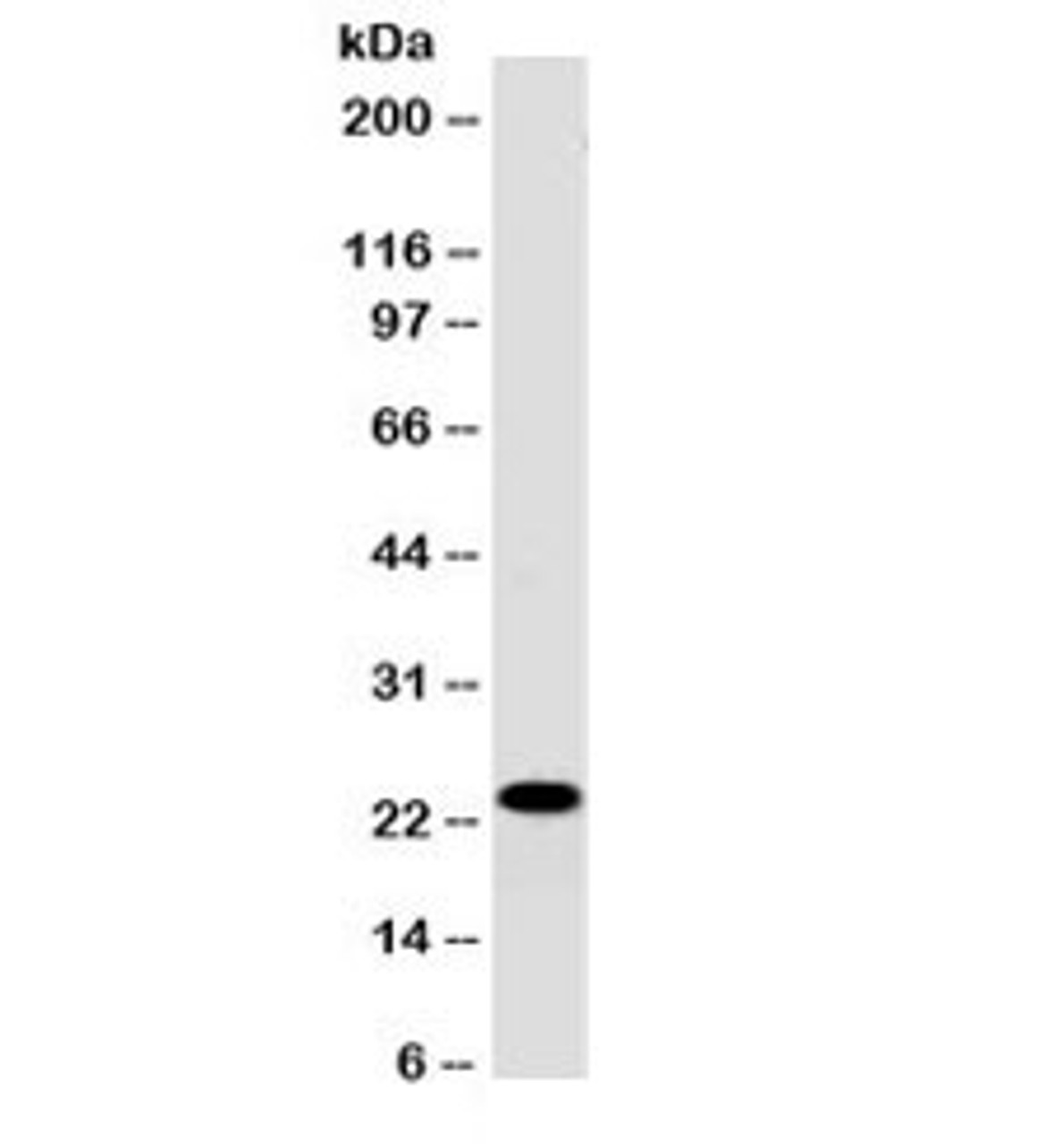 Western blot testing of human Jurkat cell lysate with CD3e antibody (clone PC3/188A) . Expected molecular weight ~23 kDa.