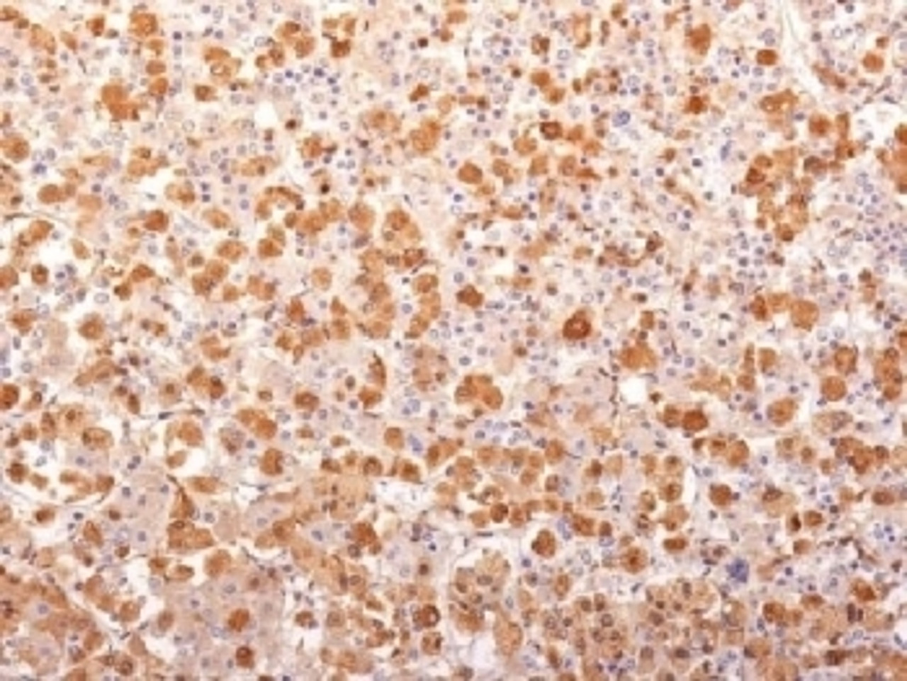 IHC testing of FFPE human pituitary gland with recombinant ACTH antibody (clone r57) . Required HIER: boil tissue sections in 10mM citrate buffer, pH 6, for 10-20 min followed by cooling at RT for 20 min.