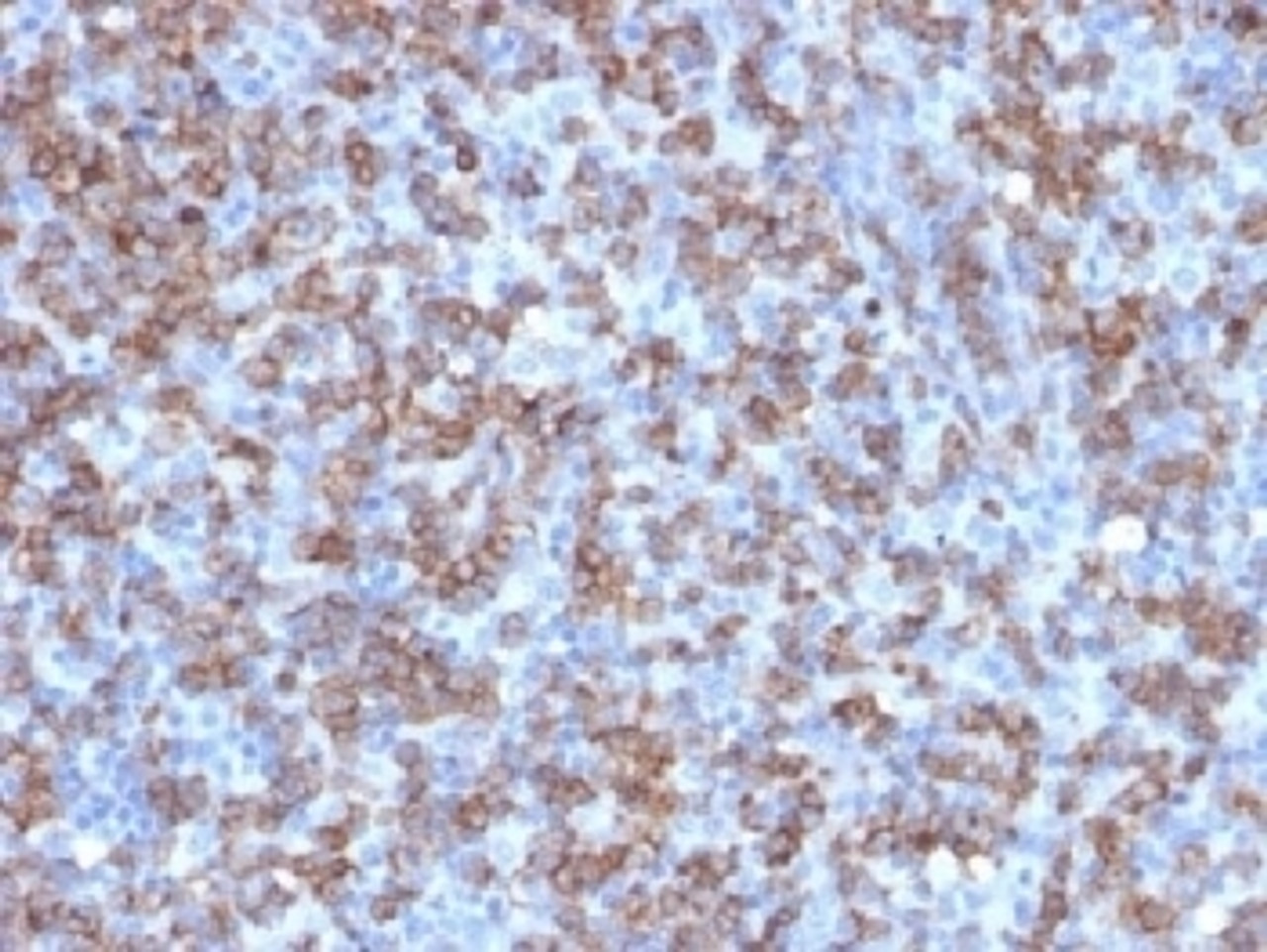 IHC testing of FFPE human tonsil with recombinant CD8 antibody (clone C8/1779R) . Required HIER: boil tissue sections in 10mM citrate buffer, pH 6, for 10-20 min followed by cooling at RT for 20 min.