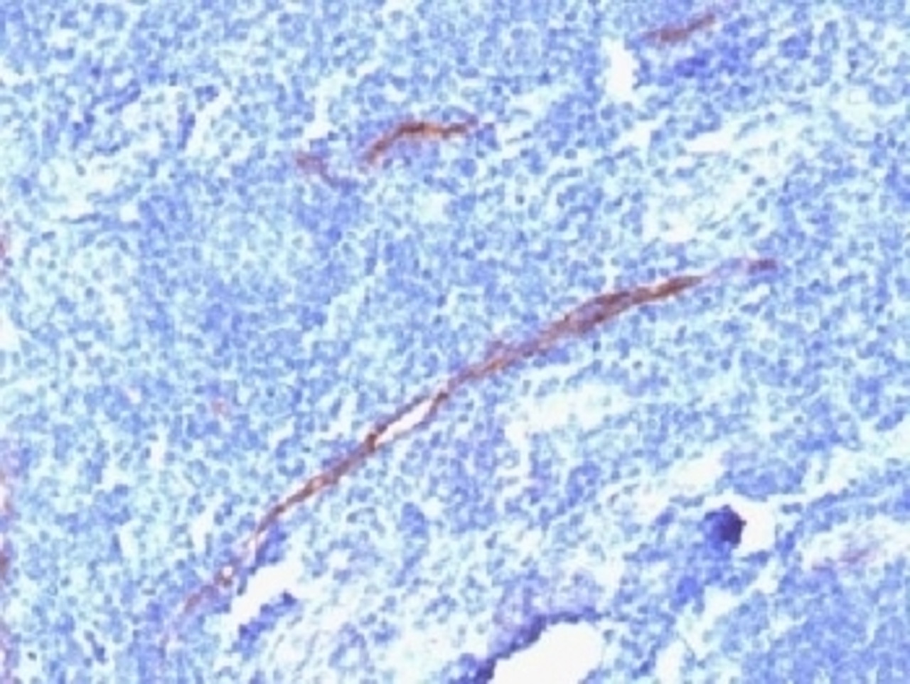 IHC testing of FFPE human tonsil with recombinant CD34 antibody (clone HPCA1/1806R) . Required HIER: boil tissue sections in 10mM Tris with 1mM EDTA, pH 9, for 10-20 min followed by cooling at RT for 20 min.