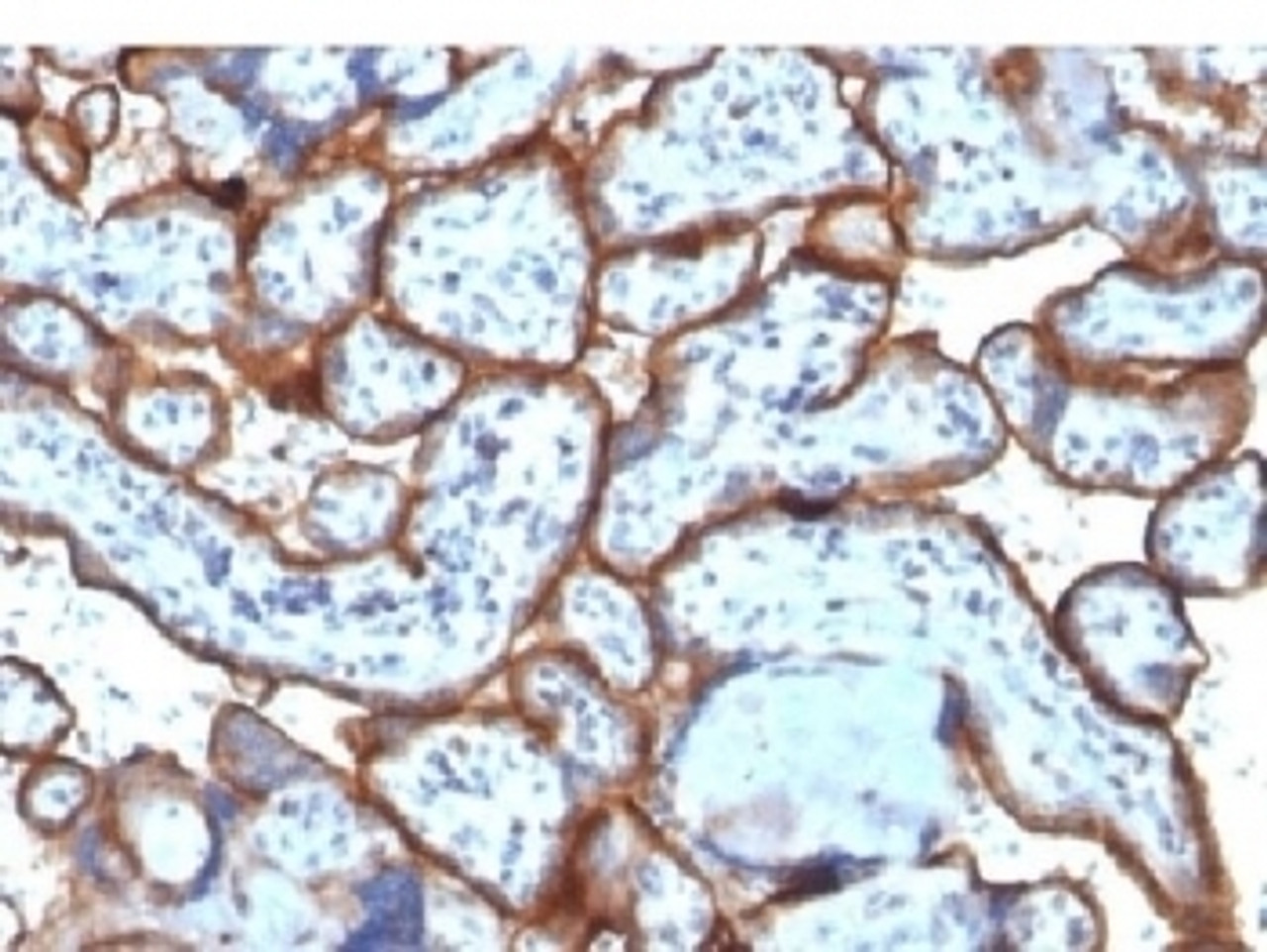 IHC testing of FFPE human placenta tissue with CD71 / Transferrin Receptor antibody (clone TFRC/1818) . Required HIER: boil tissue sections in 10mM Tris with 1mM EDTA, pH 9, for 10-20 min followed by cooling at RT for 20 min.