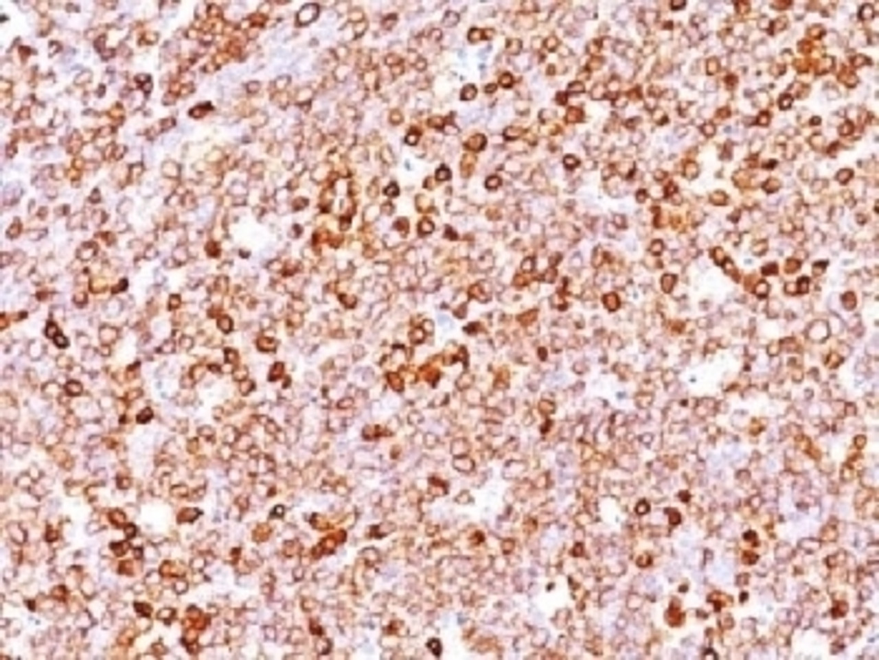 IHC testing of FFPE human tonsil with recombinant CD79a antibody (clone IGA/1688R) . Required HIER: boil tissue sections in 10mM citrate buffer, pH 6, for 10-20 min followed by cooling at RT for 20 min.