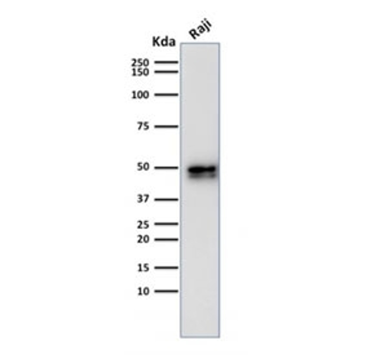 Western blot testing of human Raji cell lysate with recombinant CD79a antibody (clone IGA/1790R) . Expected molecular weight: 25-47 kDa depending on glycosylation level.