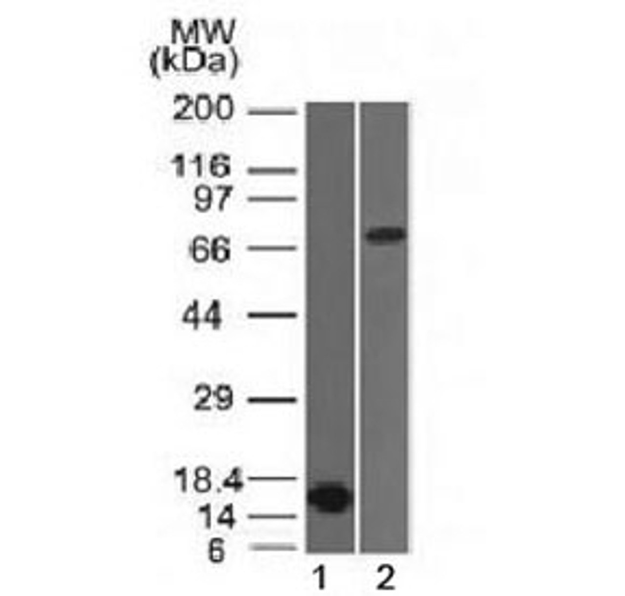 Western blot testing of 1) partial recombinant protein and 2) human HepG2 lysate with Bcl6 antibody (clone BCL6/1475) . Expected molecular weight: 78/95kDa (non-phosphorylated/phosphorylated) .