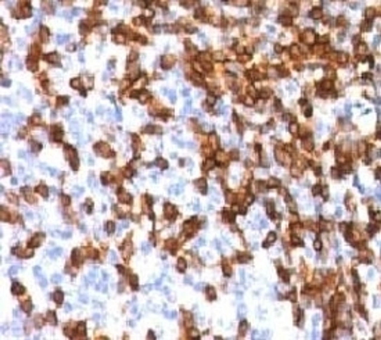 Formalin-fixed, paraffin-embedded human tonsil stained with CD44 antibody (HCM15-1)