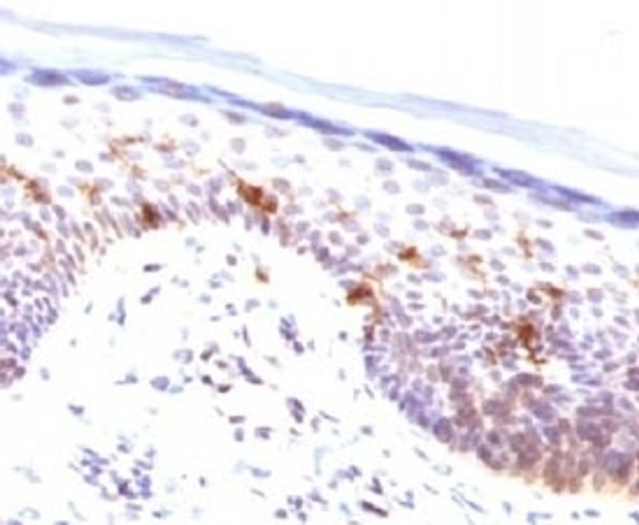 IHC testing of human human skin stained with CD1a antibody (CLDA1a) .