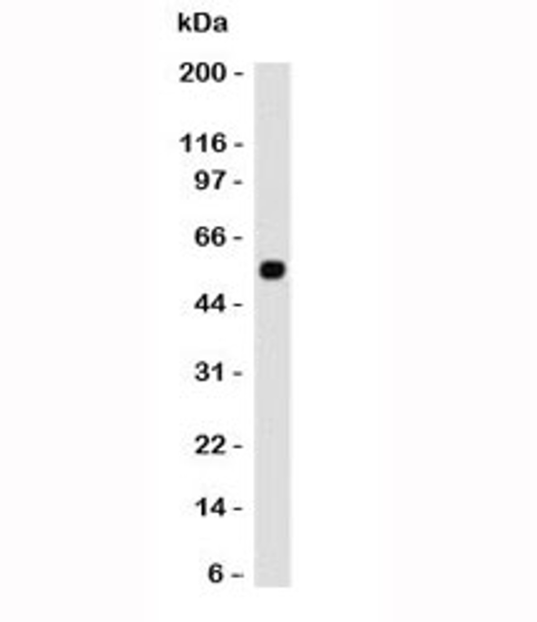 Western blot testing of human samples with p53 antibody (CTA53-1) .