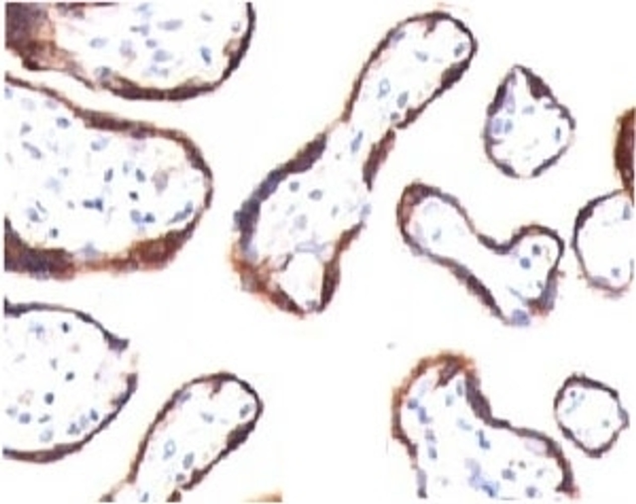 IHC testing of FFPE human placenta and HCG-beta antibody (CGB63) .