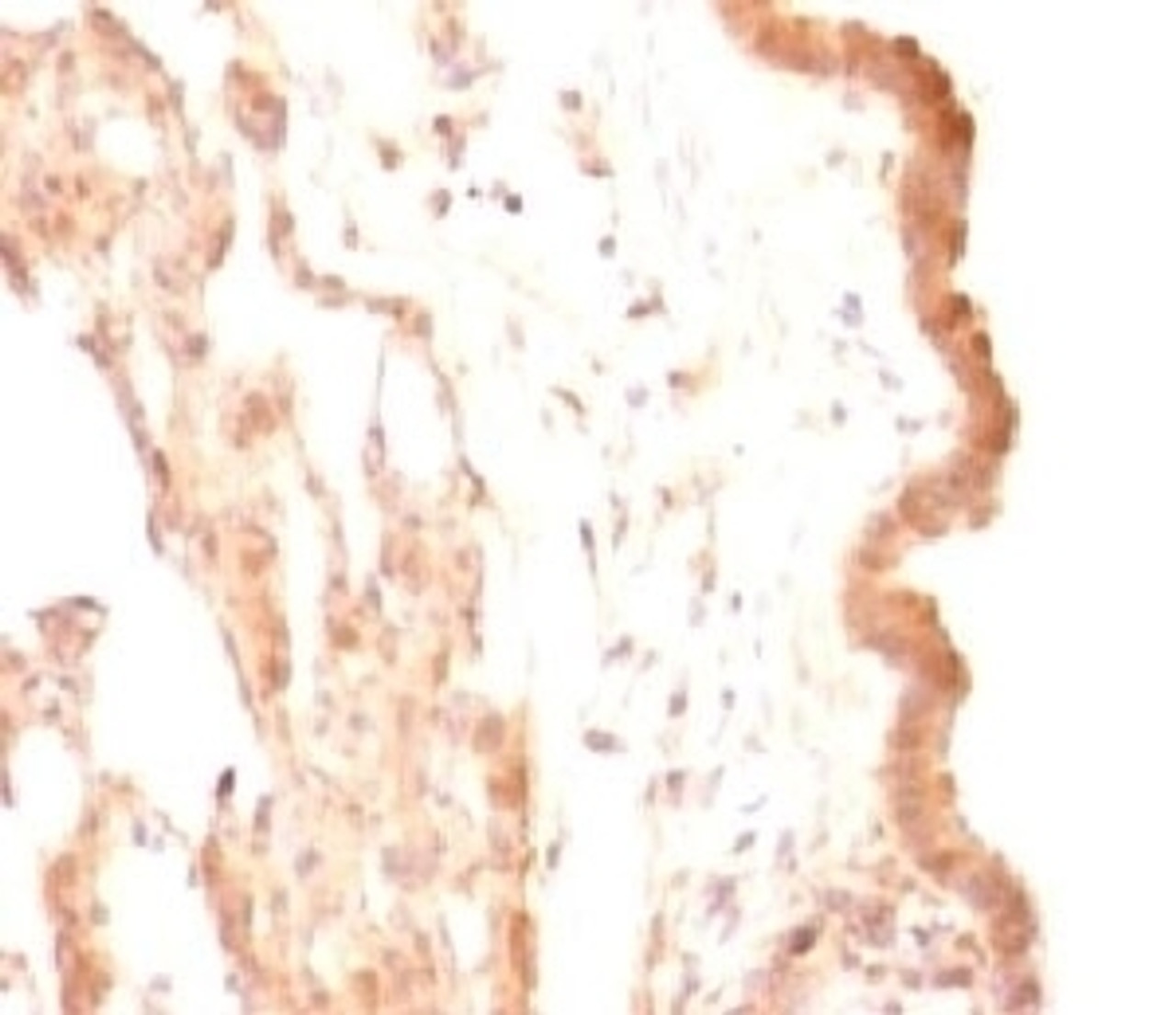 IHC testing of FFPE rat lung with Glypican-3 antibody (SGPN3-1) .