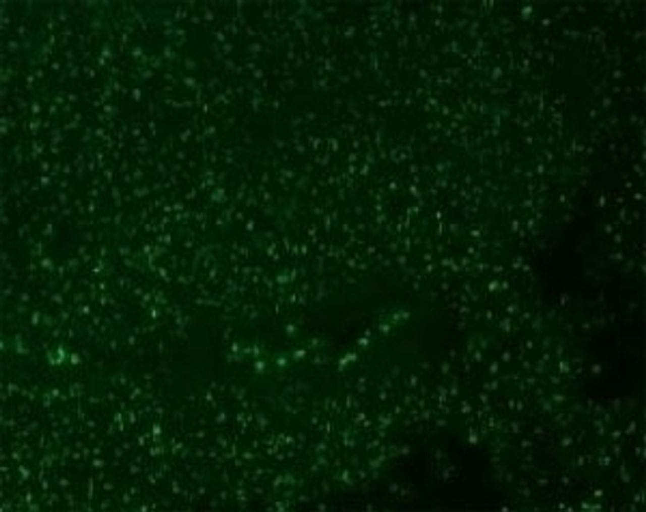 Immunofluorescent testing of Alexa Fluor 488 conjugated Nucleoli marker antibody and human colon carcinoma.