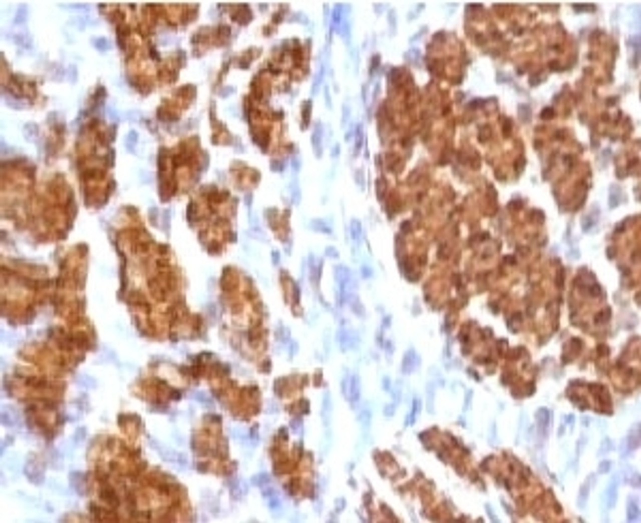 IHC testing of FFPE rat uterus and Calponin antibody (clone CLPN5-1) .