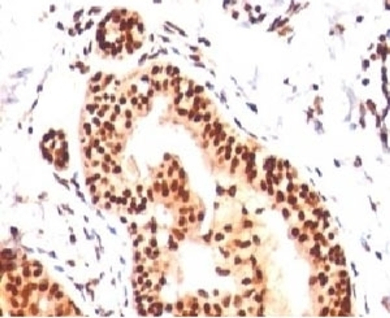 IHC analysis of human tonsil with SUMO2/3 antibody (clone S23MT-1) .