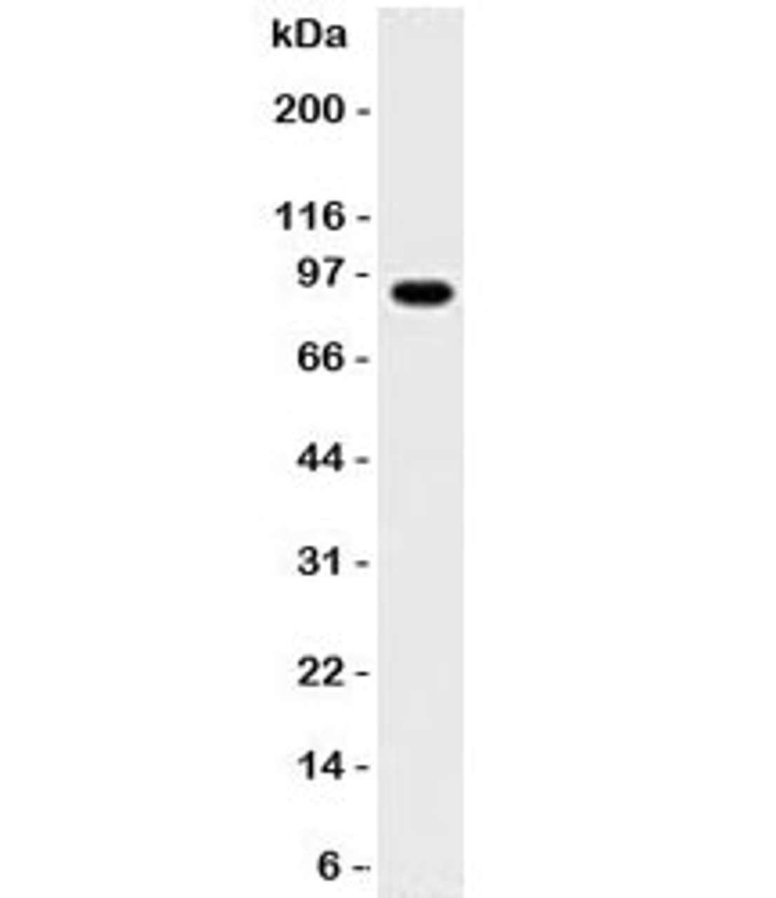 Western blot testing of Daudi lysate with MALT1 antibody. Expected molecular weight ~92 kDa.