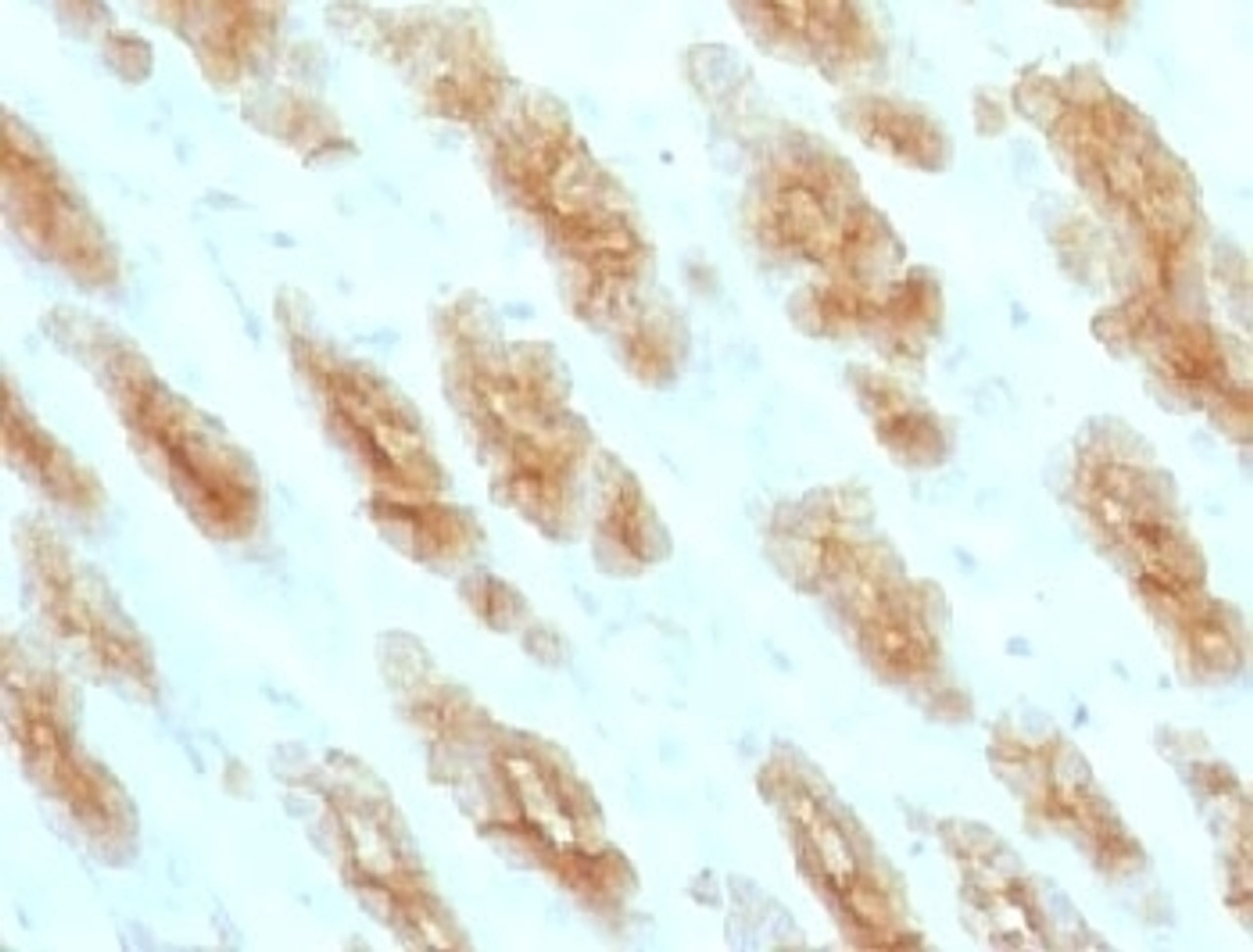 IHC testing of FFPE rat stomach with Basic Cytokeratin antibody.