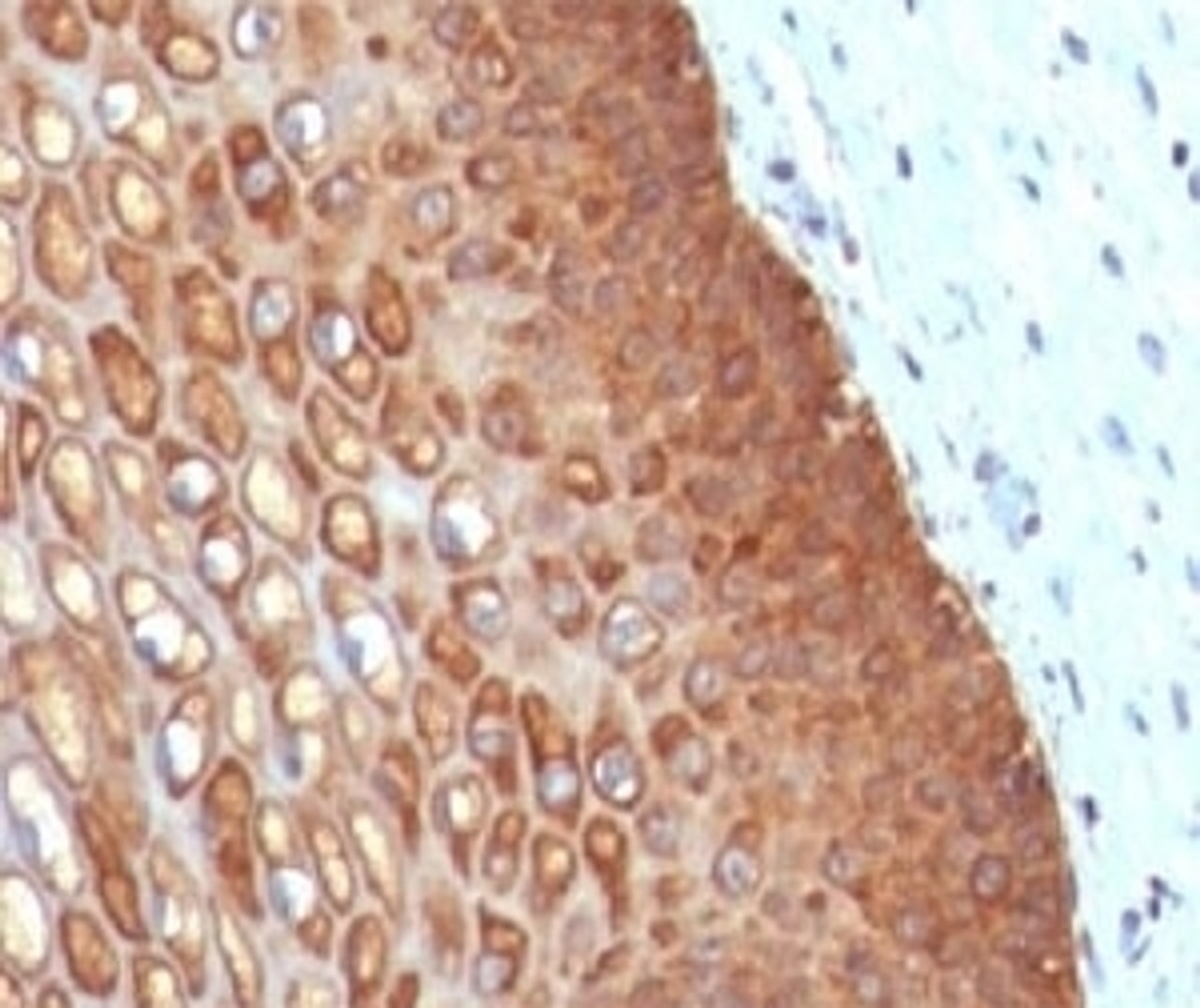 IHC testing of FFPE human cervix with Keratin 14 antibody.