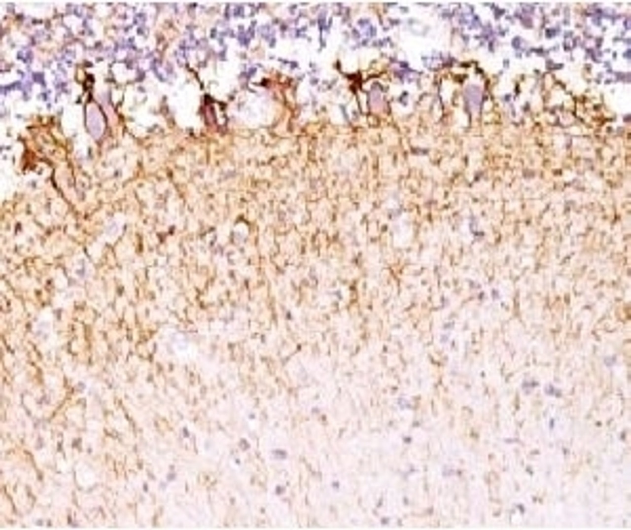 IHC testing of FFPE human cerebellum with Neurofilament antibody (clone MSI27-1) .