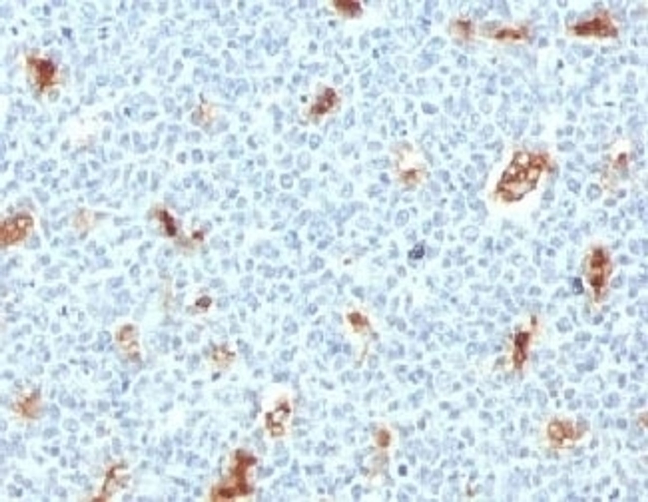 IHC testing of FFPE human tonsil with S100A9 antibody (clone PS1A9-1) .