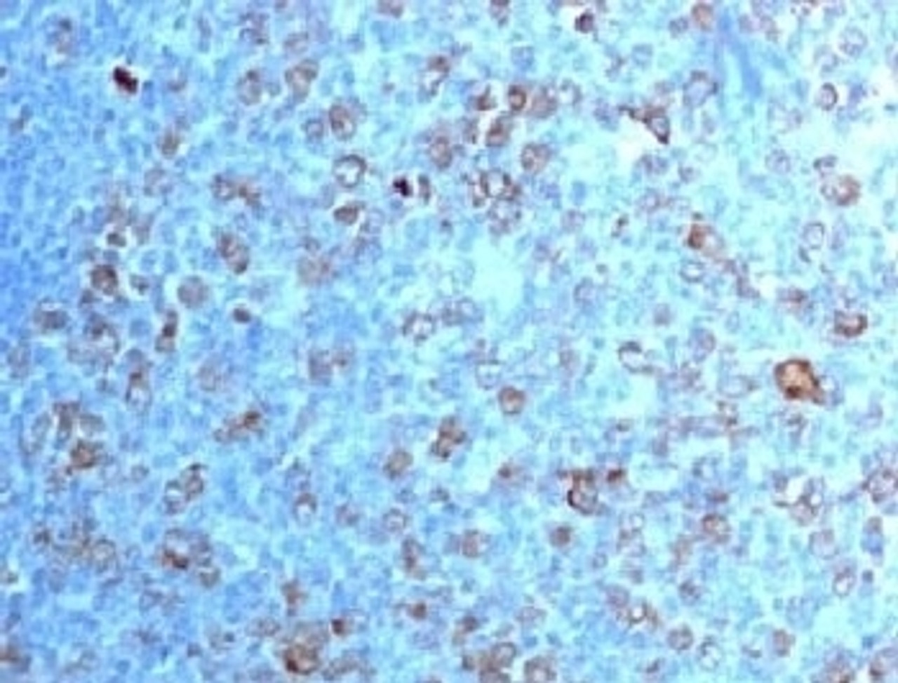 IHC testing of FFPE human tonsil with CDK1 antibody (clone CDVC2-1) .