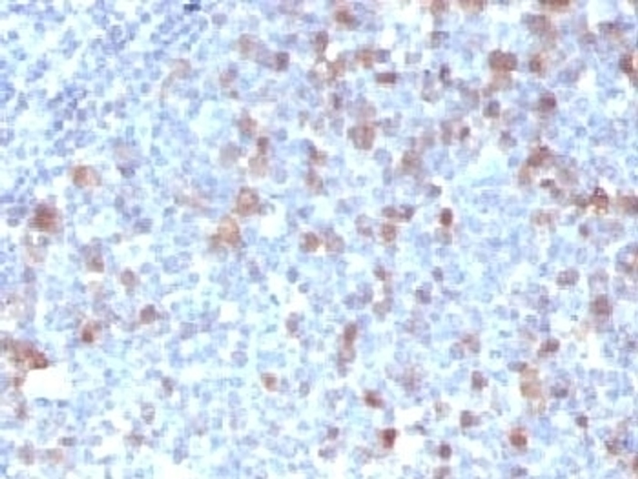 IHC testing of FFPE human tonsil with Cdc20 antibody (clone CLDC20-1)