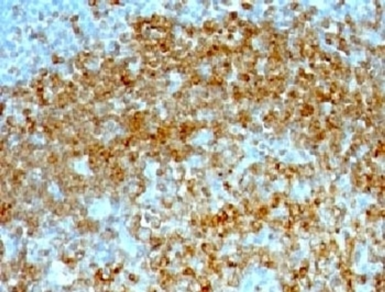 IHC testing of FFPE human tonsil with CD74 antibody (clone CDLA74-1) .