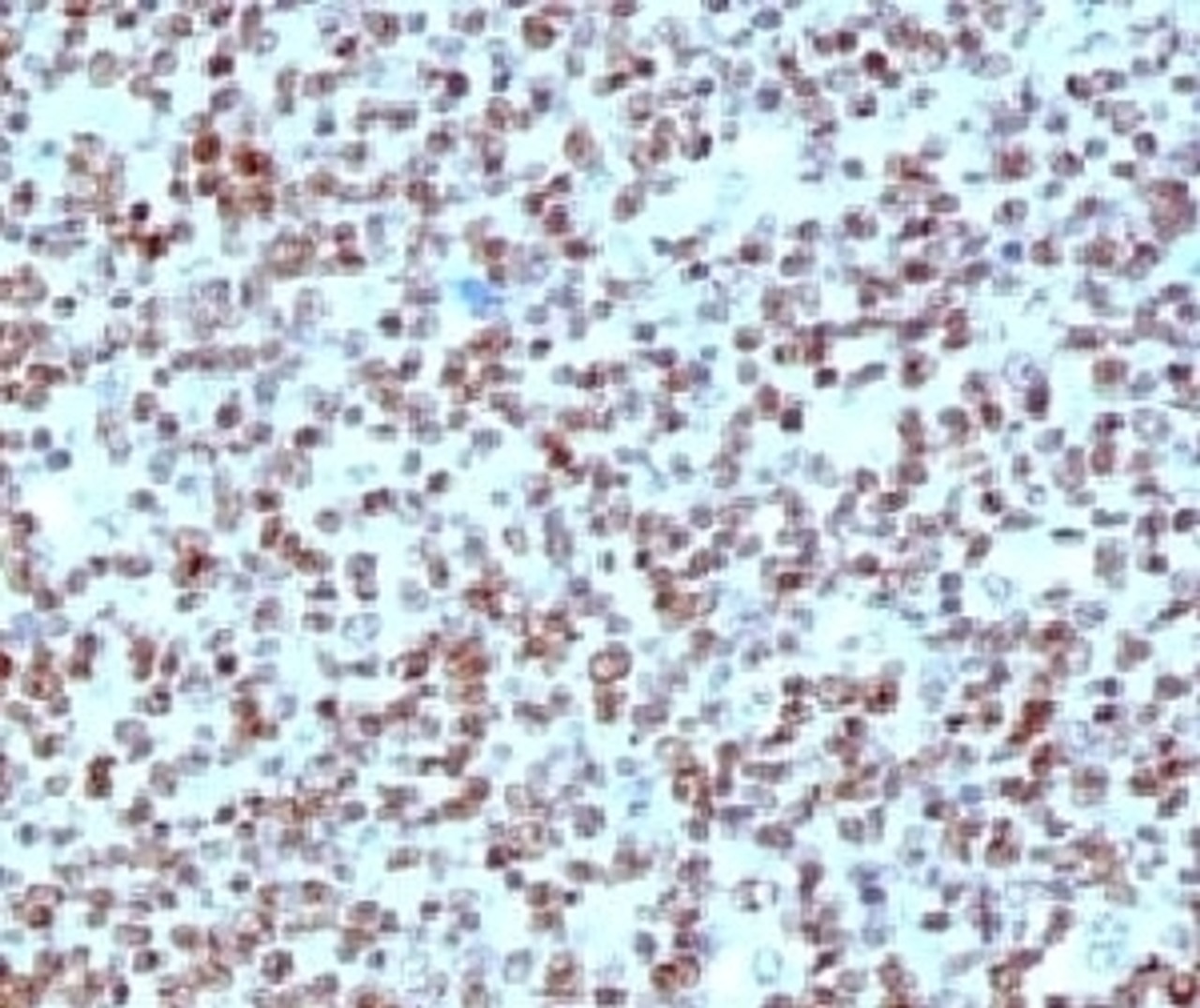 IHC testing of FFPE human tonsil with Nucleolin antibody (clone NPC23-2) .