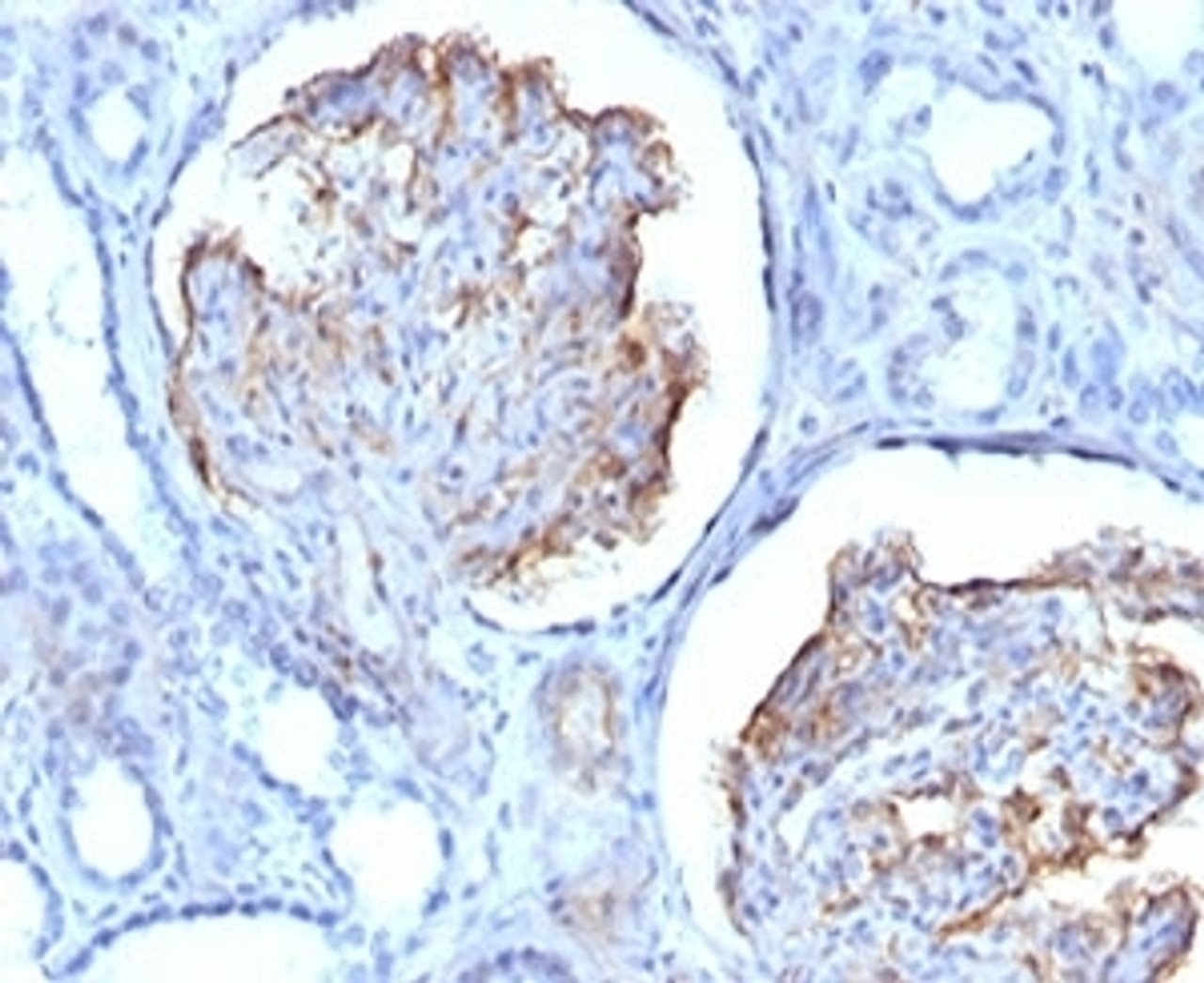 Formalin-fixed, paraffin-embedded human kidney stained with WT1 antibody (clone RMWT1-1) .