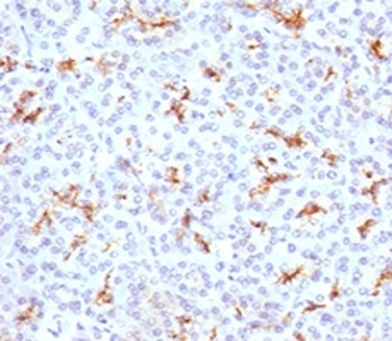 IHC testing of FFPE human pancreas with CFTR antibody (clone CFTR1-1) .