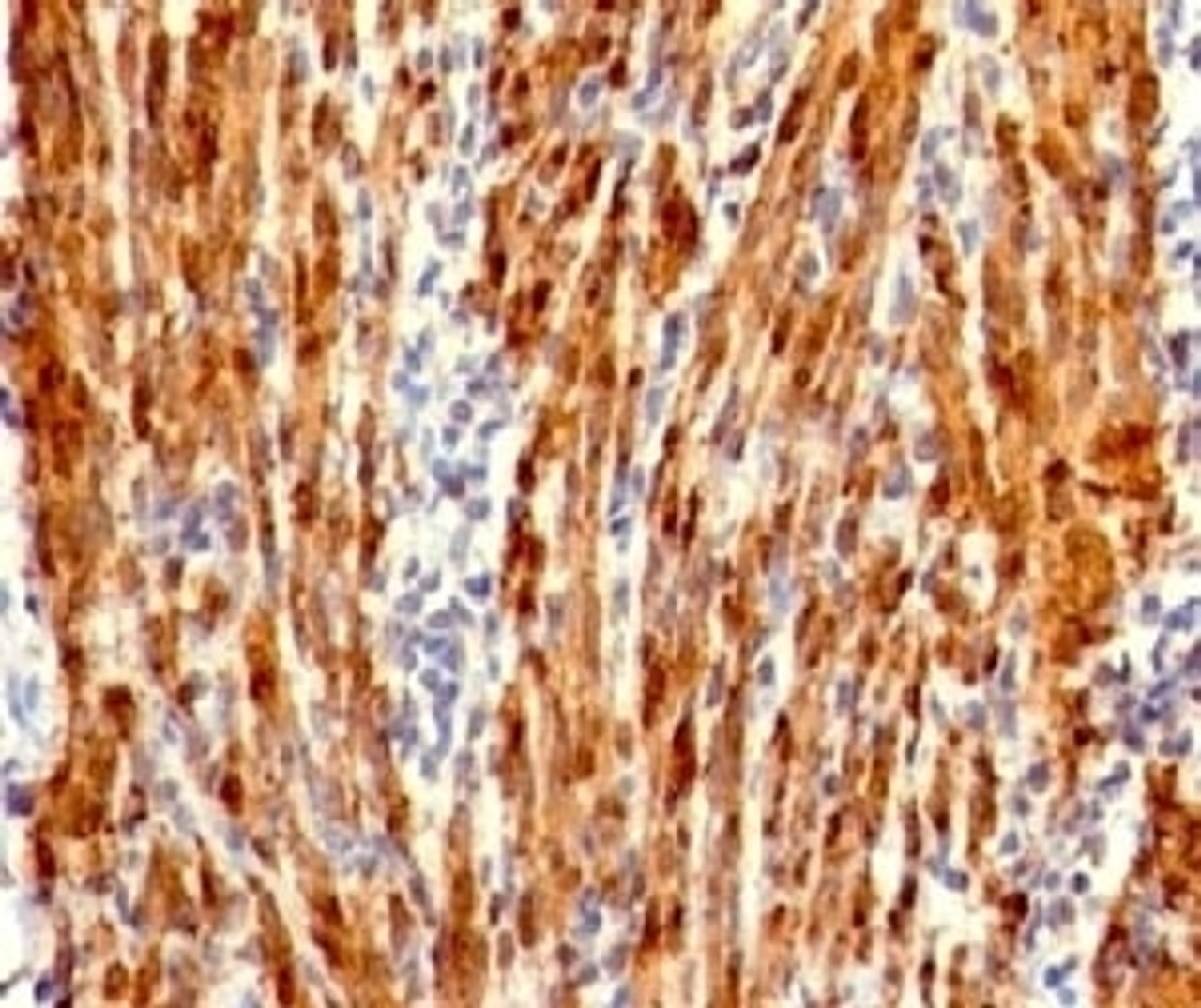 Formalin-fixed, paraffin-embedded human uterus stained with Calponin antibody (RMCN1-1) .