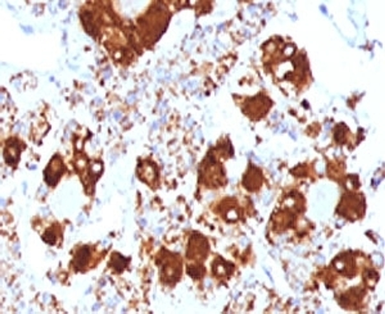 IHC testing of FFPE human pituitary gland with ACTH antibody (clone ADCT1-1) .