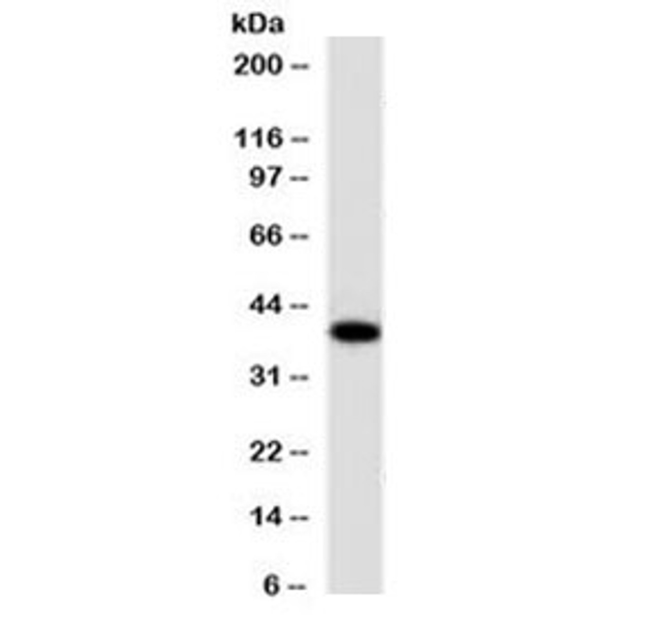 Western blot testing of human lung lysate with EpCAM antibody (clone EPM17-4) .