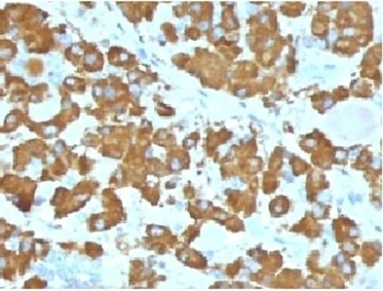 IHC testing of FFPE human pituitary gland with Growth Hormone antibody (clone GRHP1-1) . Required HIER: boil tissue sections in 10mM citrate buffer, pH 6, for 10-20 min.