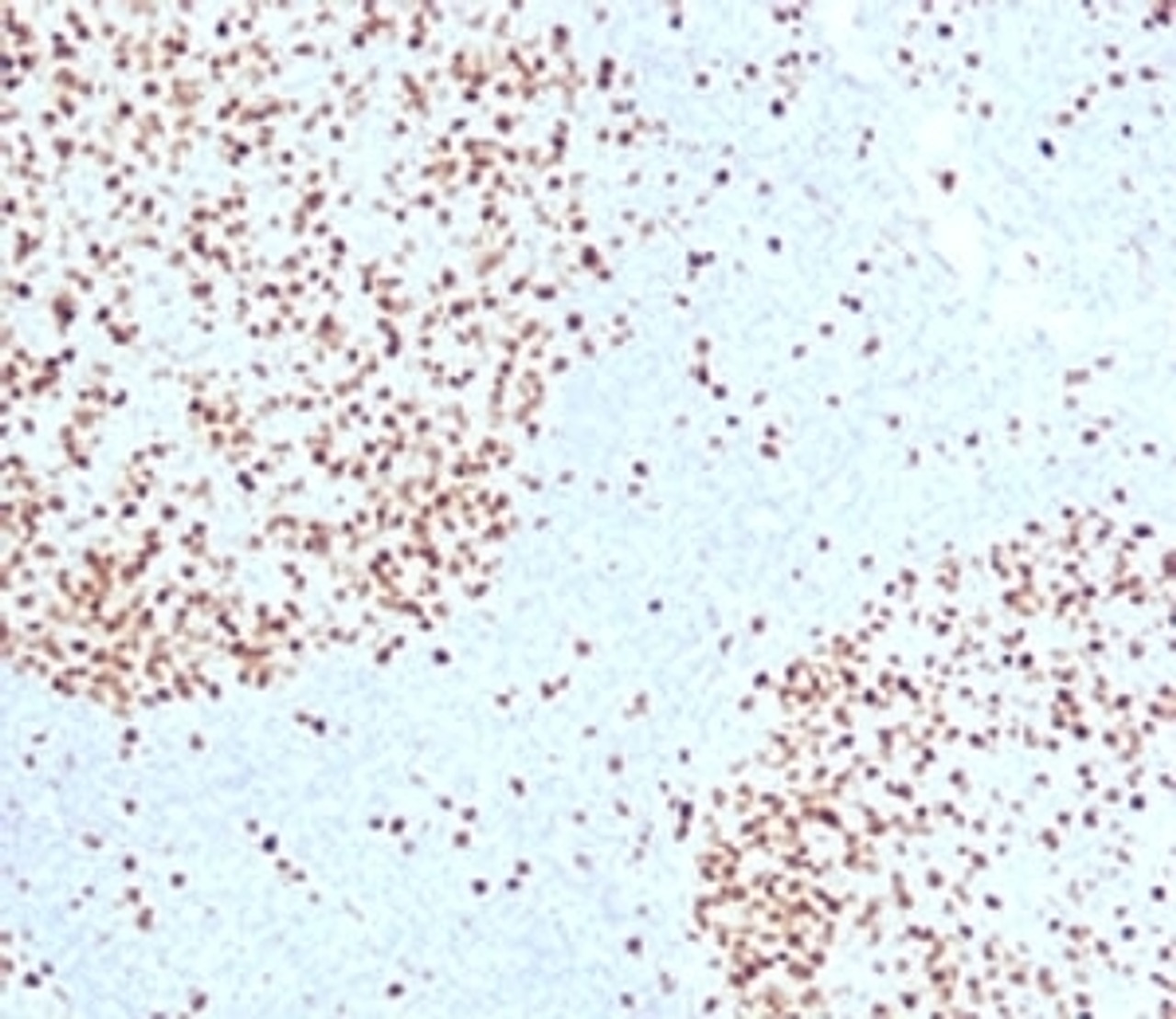 IHC testing of FFPE human tonsil with TOP2A antibody (clone TPM2A-1) .