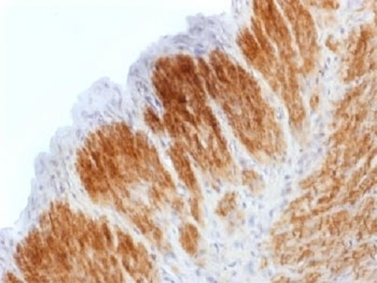 IHC testing of FFPE rat uterus stained with recombinant Calponin antibody (clone CNN1/1408R) . HIER: steam sections in 10mM Tris with 1mM EDTA, pH 9.0, for 10-20 min.