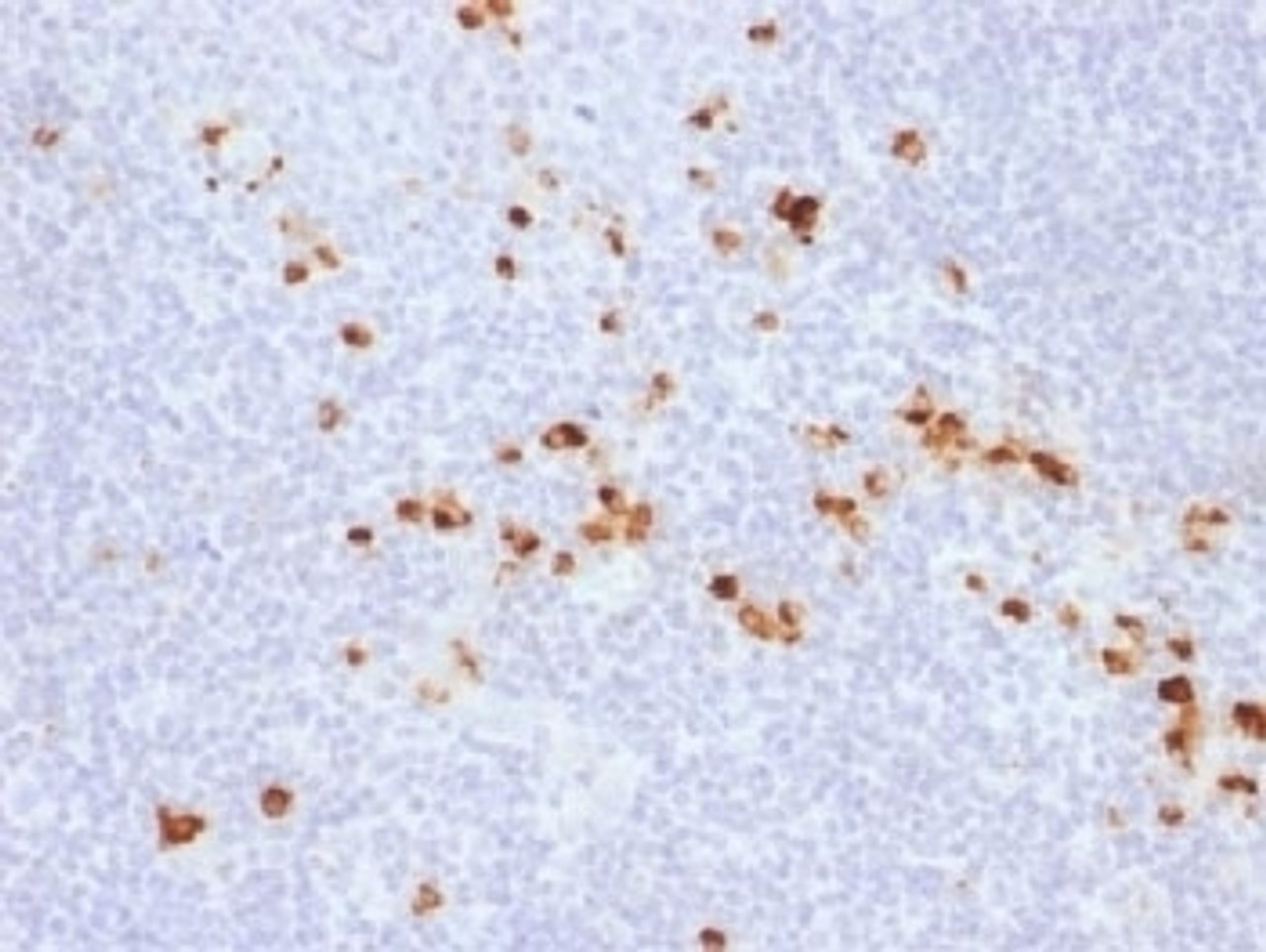 IHC testing of FFPE human tonsil with recombinant IgG antibody (clone IG507R) . HIER: steam sections in 10mM citrate buffer, pH 6.0, for 10-20 min.