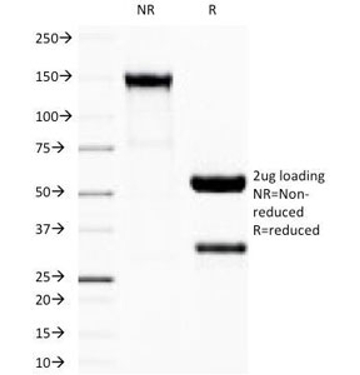 SDS-PAGE Analysis of Purified, BSA-Free Recombinant IgG Antibody (clone IG507R) . Confirmation of Integrity and Purity of the Antibody.