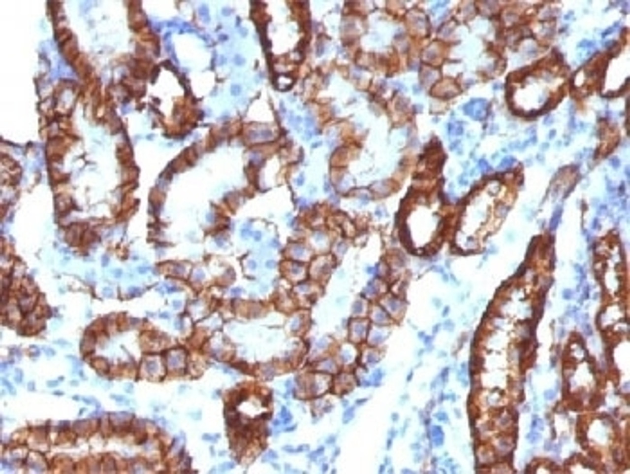 IHC testing of FFPE mouse kidney tissue with recombinant Cadherin 16 antibody (clone CDH16/1532R) . Required HIER: steam sections in 10mM Tris with 1mM EDTA, pH 9.0, for 10-20 min.