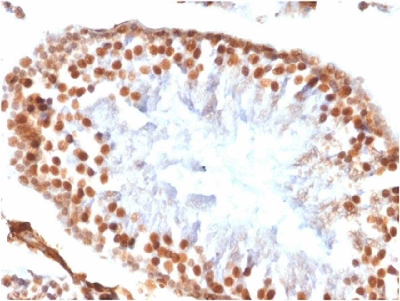 IHC testing of FFPE rat testis tissue with recombinant WT1 antibody (clone WT1/1434R) . HIER: steam sections in 10mM citrate buffer, pH 6.0, for 10-20 min.