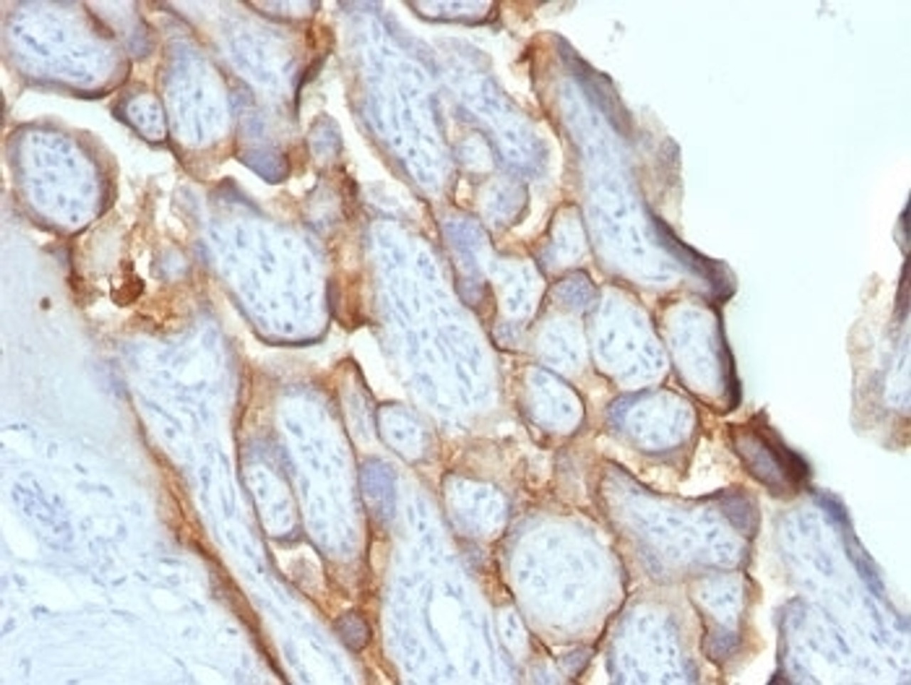 Formalin-fixed, paraffin-embedded human placenta stained with hCG beta antibody (SPM529) .