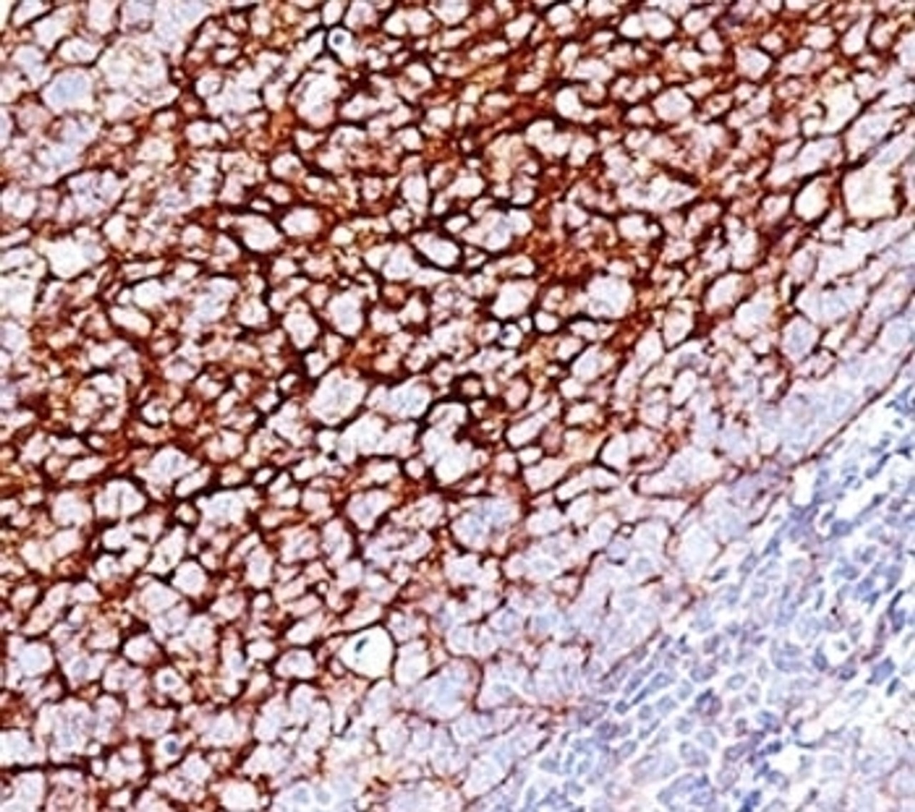 Formalin-fixed, paraffin-embedded human tonsil stained with CD35 antibody (SPM554) .