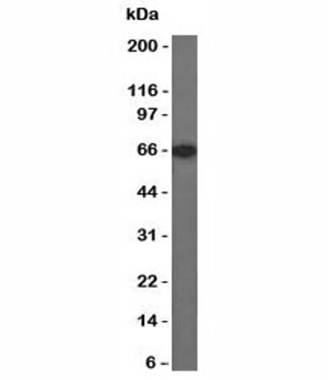 Western blot of Estrogen Receptor in MCF-7 lysate using Estrogen Receptor antibody (SPM567) .