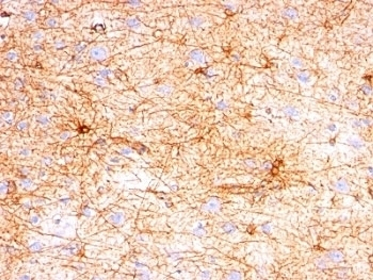 Formalin-fixed, paraffin-embedded human cerebellum stained with GFAP antibody (SPM507) .