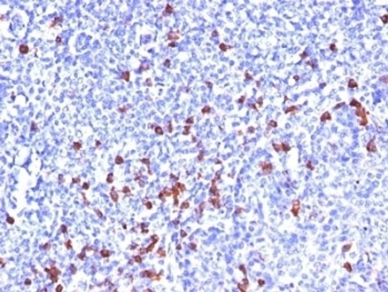 Formalin-fixed, paraffin-embedded human tonsil stained with Kappa Light Chain antibody (SPM508) .