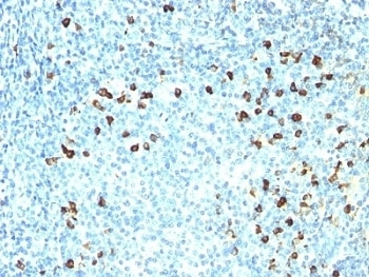 Formalin-fixed, paraffin-embedded human tonsil stained with anti-Kappa antibody (SPM558) .