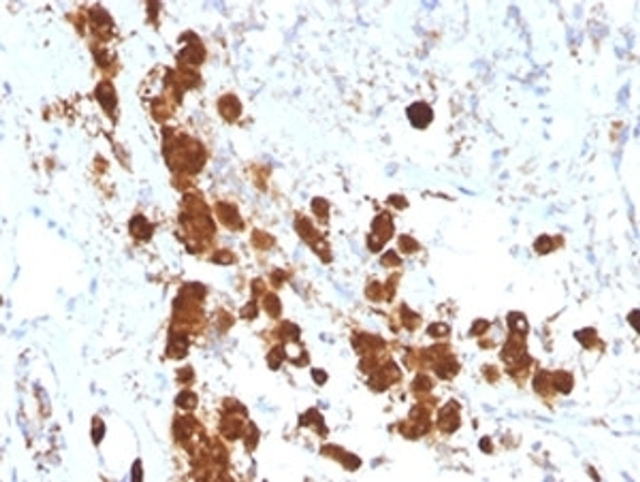 IHC testing of FFPE human pituitary gland with anti-ACTH antibody (clone SPM333) .